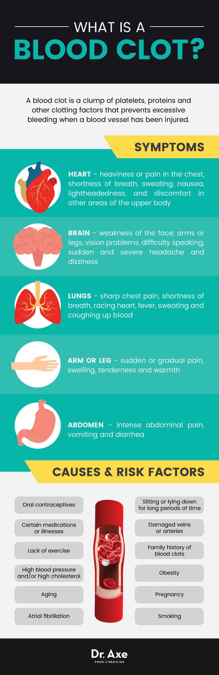 Blood clots: causes 7 symptoms