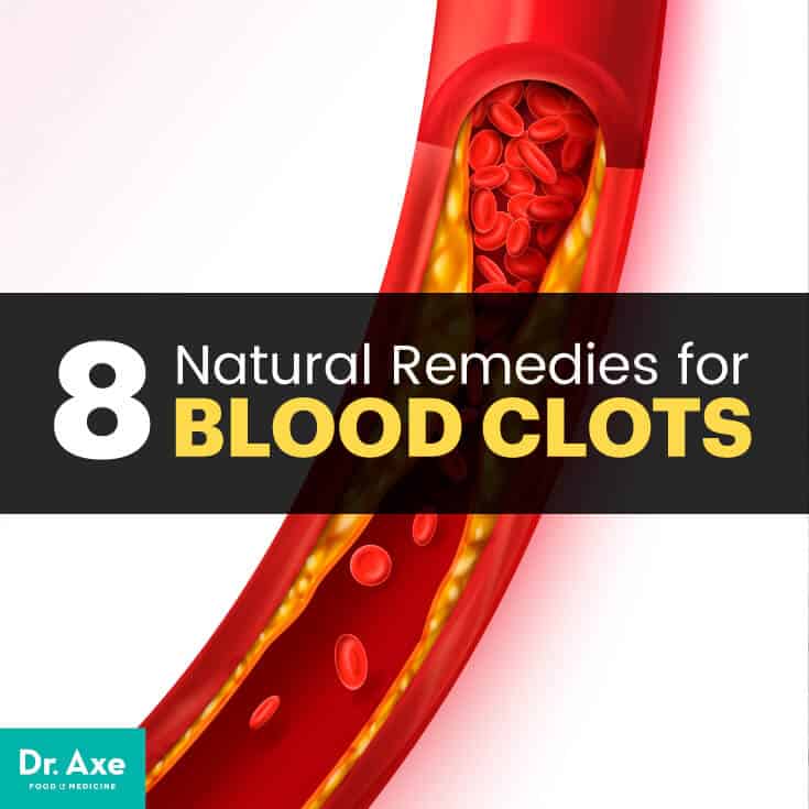 Blood clots