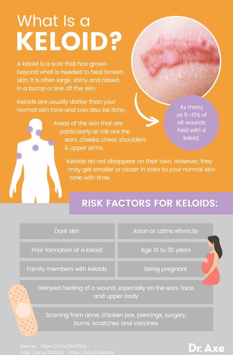 What is a keloid? - Dr. Axe